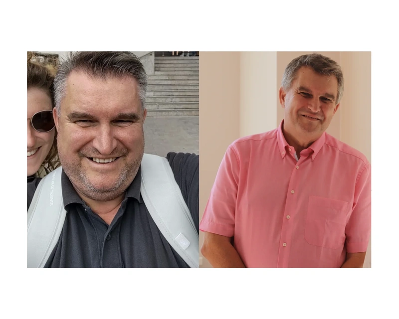 Richard before and after gastric bypass Richard before and after gastric bypass