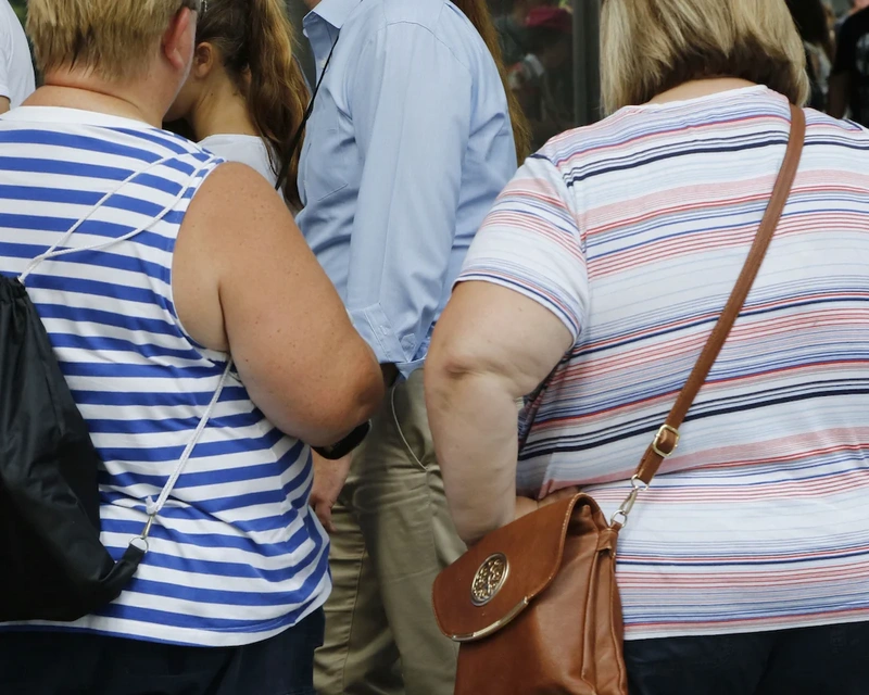 WHY TREAT OBESITY? WHY TREAT OBESITY?