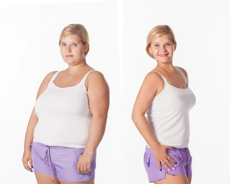 TYPES OF BARIATRIC SURGERY TYPES OF BARIATRIC SURGERY